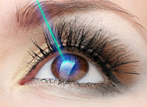 IOL - Blog - Lasik – Cirurgia de correção ocular a laser (thumb)