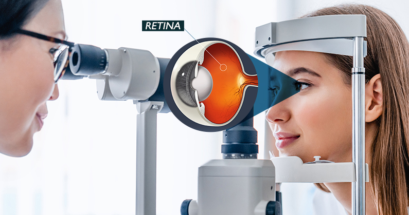Hospital de Olhos Limongi - Blog - Fatores de risco para o descolamento de retina