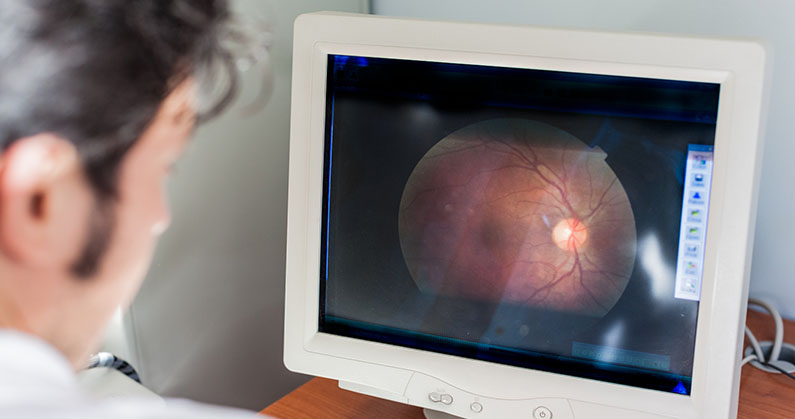 Hospital de Olhos Limongi - Blog - 5 Descolamento de retina_ entenda